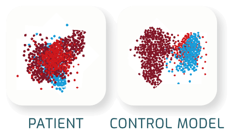 PCA control cells of patient into control model